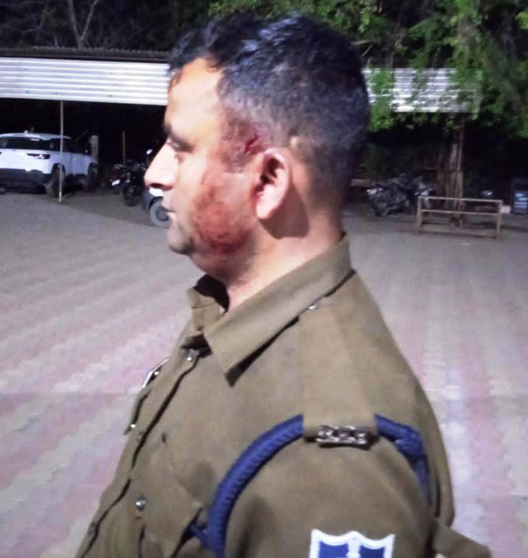 Singrauli News: सिंगरौली में पुलिस कर्मी पर हमला कर किया लहूलुहान; जानिए