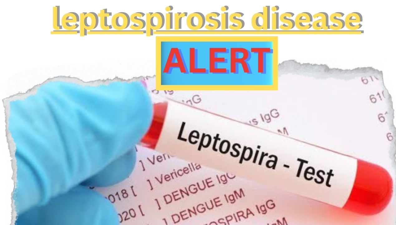 Leptospirosis alert: सतना तक पहुंच गया लेप्टोस्पायरोसिस का संक्रमण; जानिए Big News