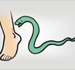 MP News: कार में बैठी बच्ची को सांप ने काटा, भीषण गर्मी में जानवर निकल रहे है बाहर; जानिए 